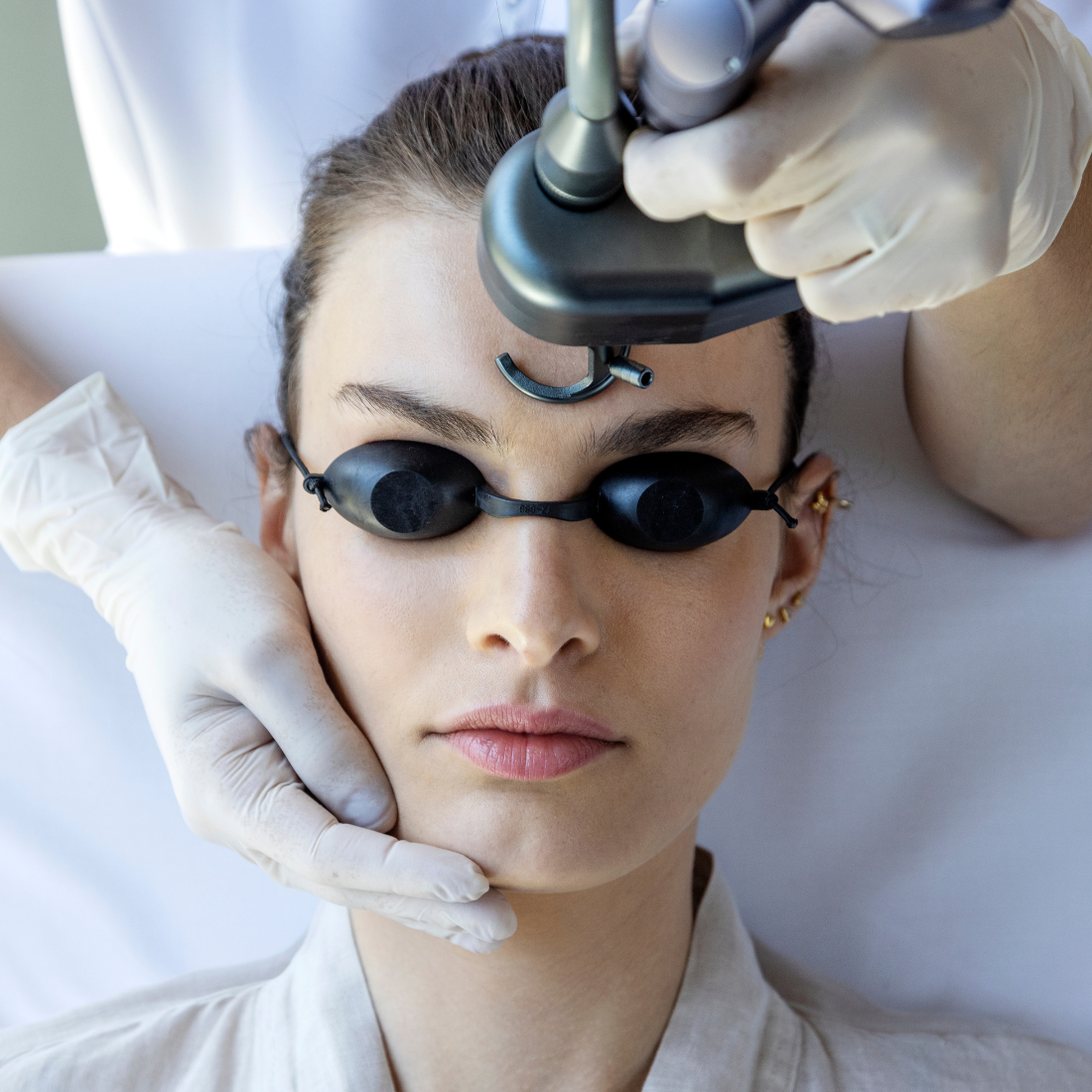 Rejuvenecimiento Facial Láser Co2 Facial Precio Laser Fraccionado